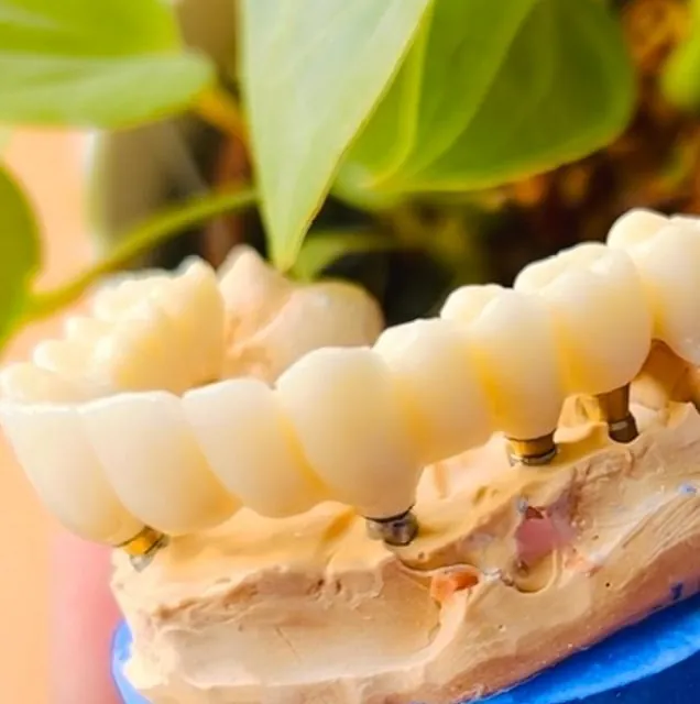 Suarez Y Vidal Laboratorio Dental