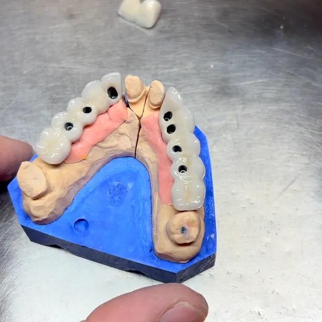 Suarez Y Vidal Laboratorio Dental