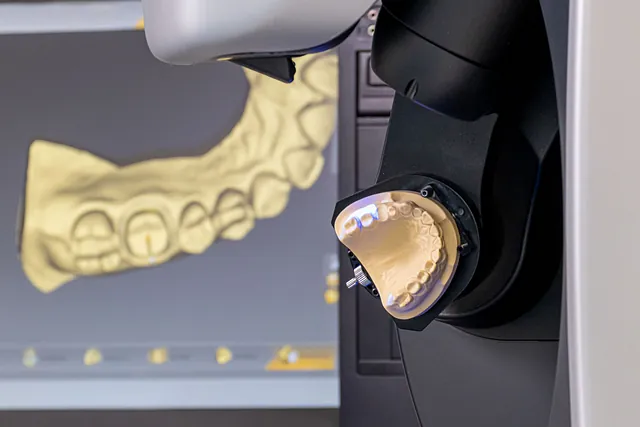 Tecnología dental