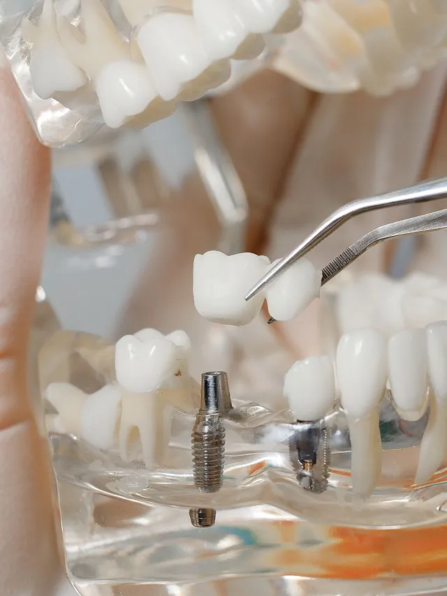 Suarez Y Vidal Laboratorio Dental