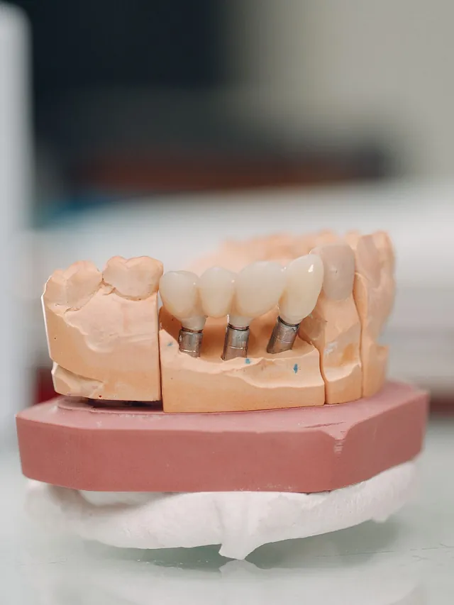 Suarez Y Vidal Laboratorio Dental